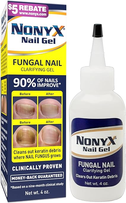 Fungal Nail Clarifying Gel | Rids Nails of Fungus by Removing Keratin Debris Where Nail Fungus Grows | 90% of Toenails Improved Using this Toenail Fungus Treatment | 4 oz
