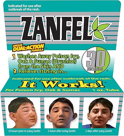 ZANFEL - Poison Ivy, Oak & Sumac Wash, 1 Oz
